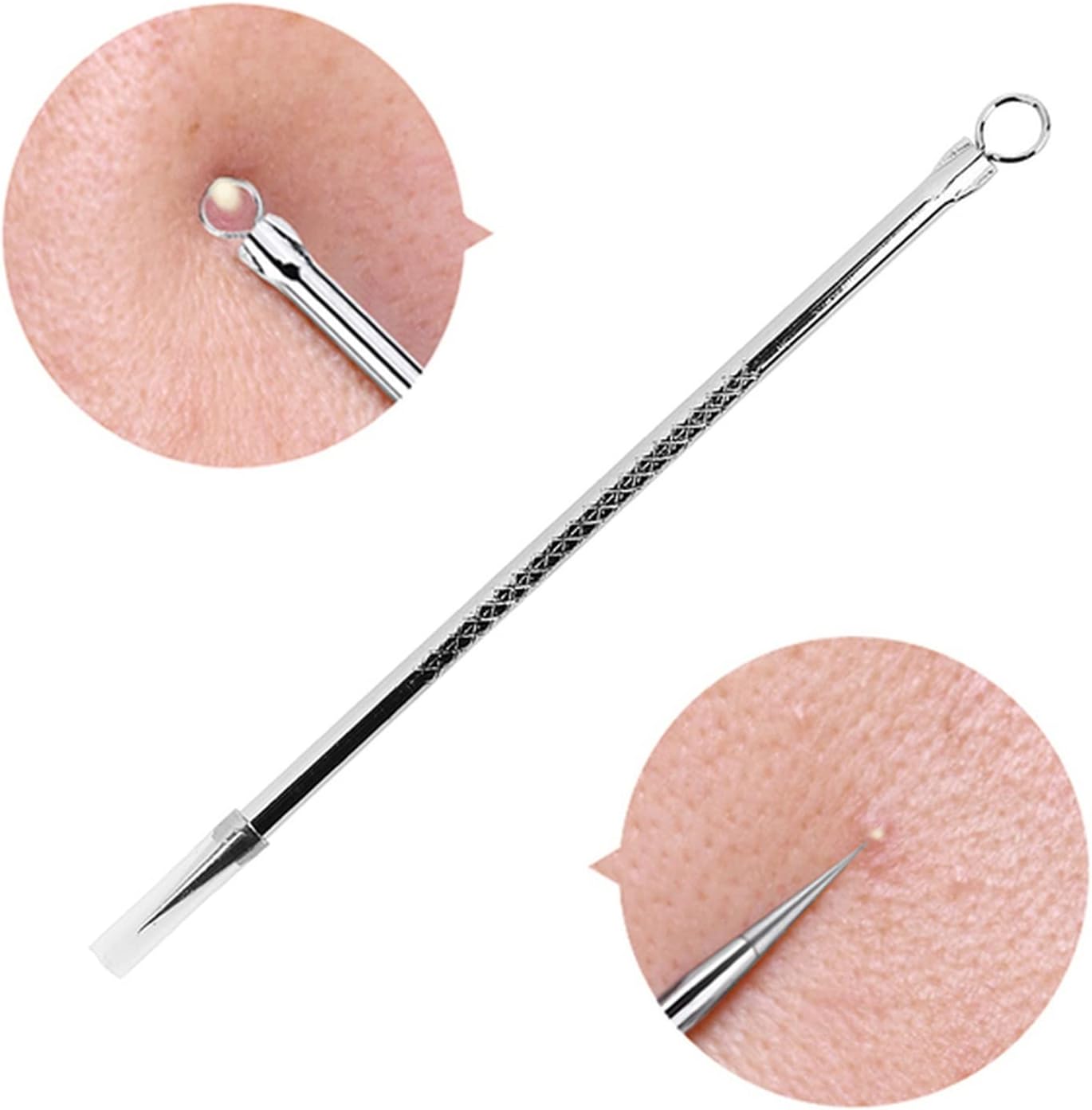 Needle Remover Clip Pimple Spoon for Face Skin Care Pore Cleaner Needle Stainless Steel Blackhead